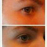 Natural Remedy For Drooping Eyelids, Sagging Eyelids Or Hooded Eyes