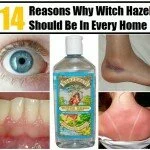 14 Reasons Why Witch Hazel Should Be In Every Home