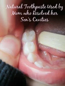 Natural Toothpaste Used By Mom Who Resolved Her Son’s Cavities