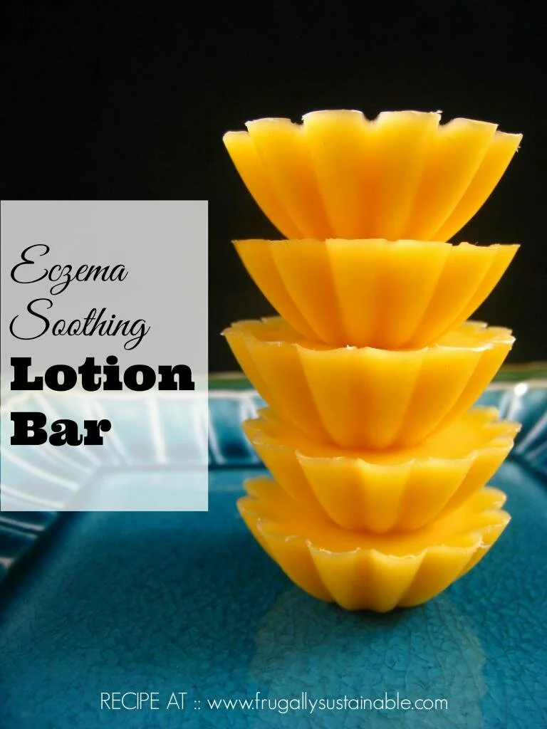 How To Make Eczema Soothing Lotion Bars